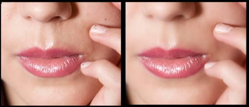 Lips and Surrounding Area 